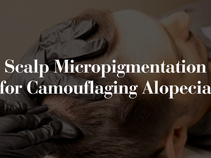 SMP for Alopecia