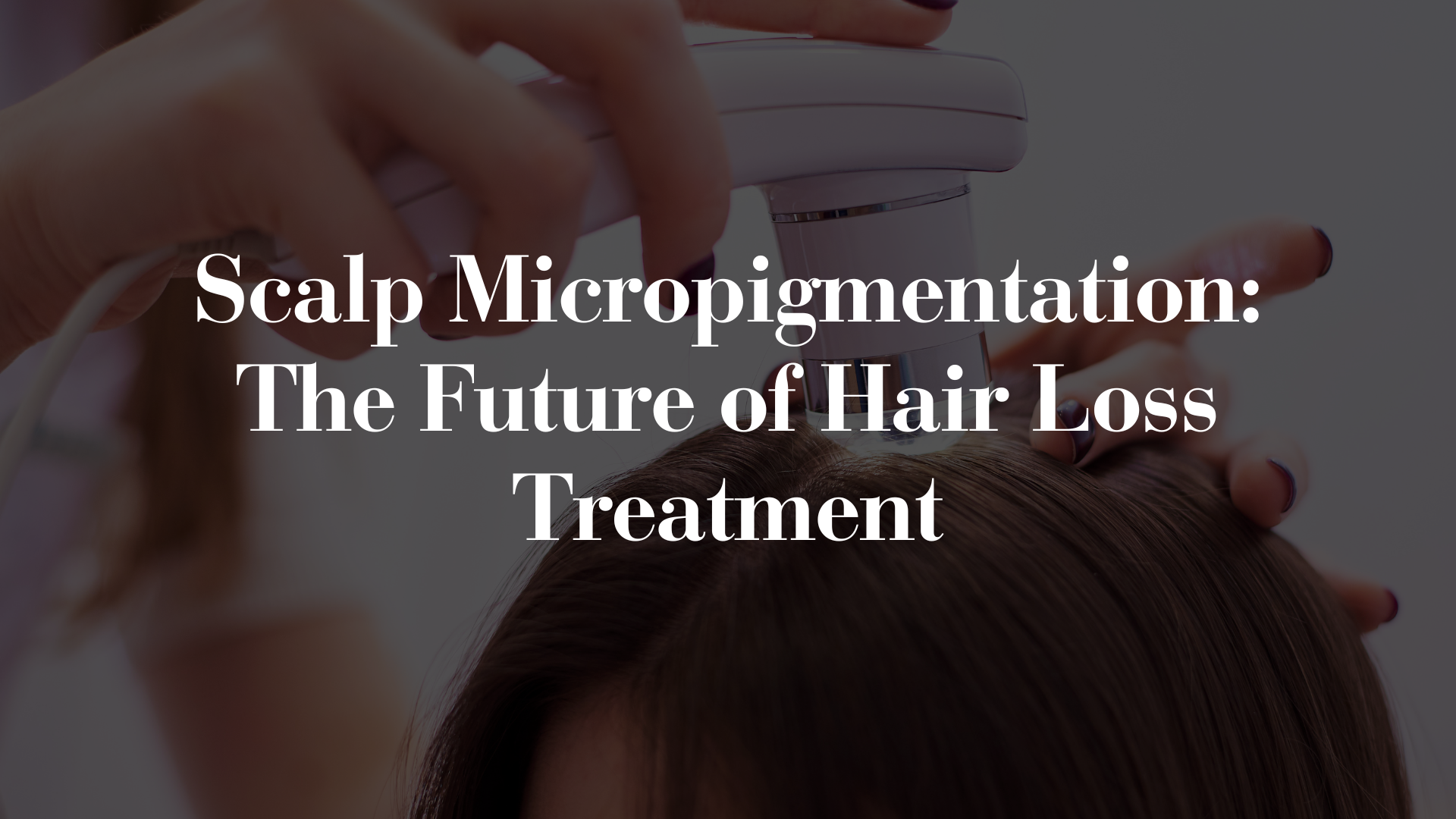 SMP: the future of hair loss treatments